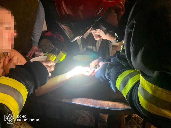 У Вінниці рятувальники різали обручку, щоб врятувати палець жінки